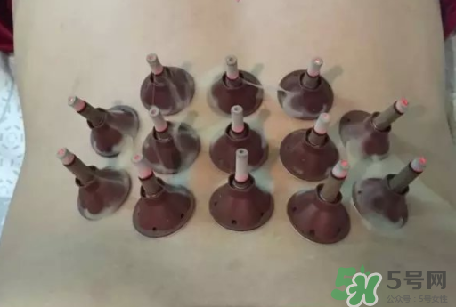 艾艾貼可以貼肚臍眼嗎？艾艾貼貼肚臍有什么作用？