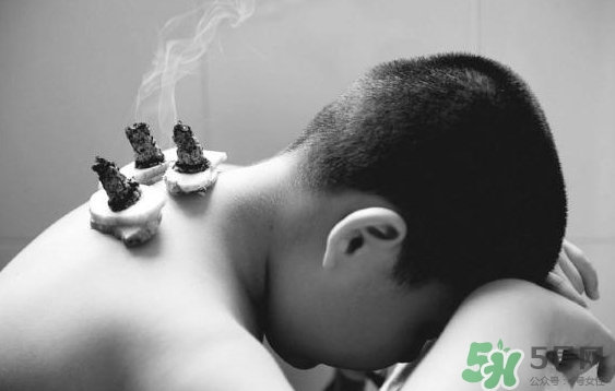 三伏灸要灸幾次？三伏灸要灸多久？