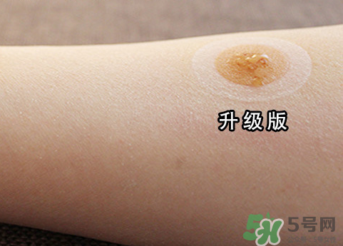艾灸貼后有水泡怎么辦？貼艾灸貼應(yīng)注意些什么？