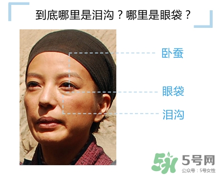 玻尿酸填充淚溝多久恢復(fù)自然？玻尿酸填充淚溝的危害