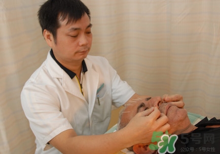 針灸可以治療失眠嗎？失眠時針灸哪些穴位有效