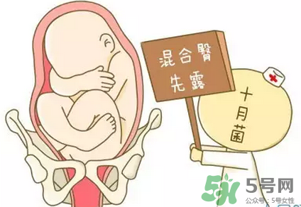 胎位不正能順產(chǎn)嗎？胎位不正怎么辦？