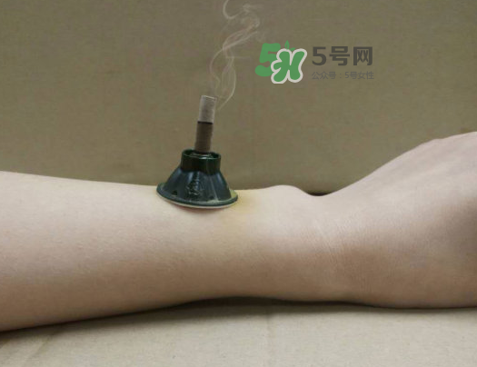 三伏天下雨可以艾灸嗎？三伏天下雨艾灸好嗎？