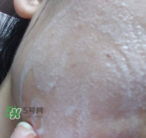 貝蜜清凈痘控油潔面啫喱怎么樣？貝蜜清祛痘控油潔面啫喱好用嗎？