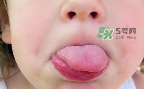 三伏天為什么濕氣重？三伏天為什么要注意祛濕？