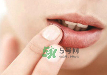你的嘴唇為什么起泡 嘴唇上的水泡治不好嗎？