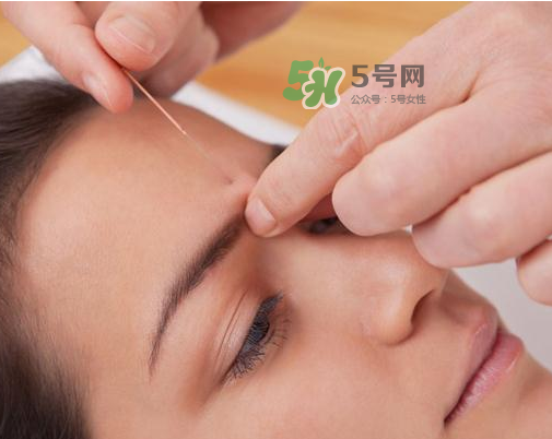 三伏天針灸有什么好處？三伏天針灸注意什么？