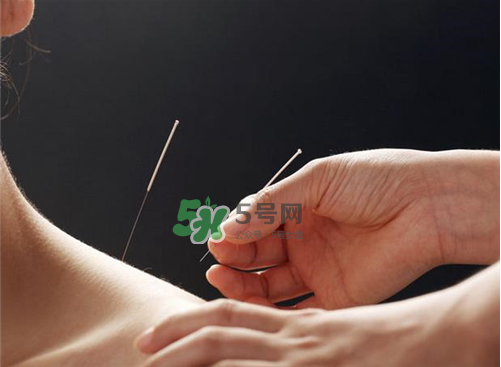 三伏天針灸有什么好處？三伏天針灸注意什么？