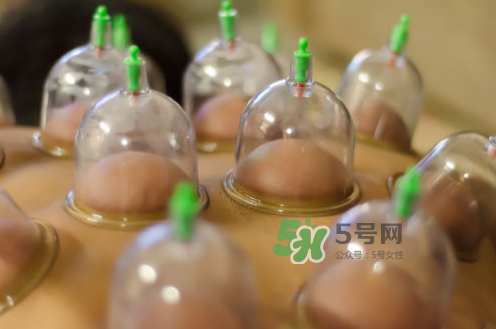 拔火罐是夏天好還是冬天好？什么時(shí)候拔火罐最合適？