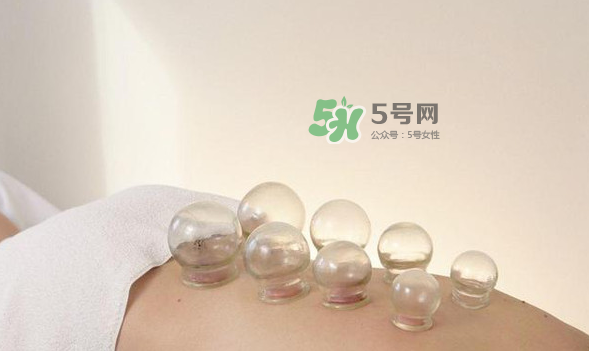 拔火罐是夏天好還是冬天好？什么時(shí)候拔火罐最合適？