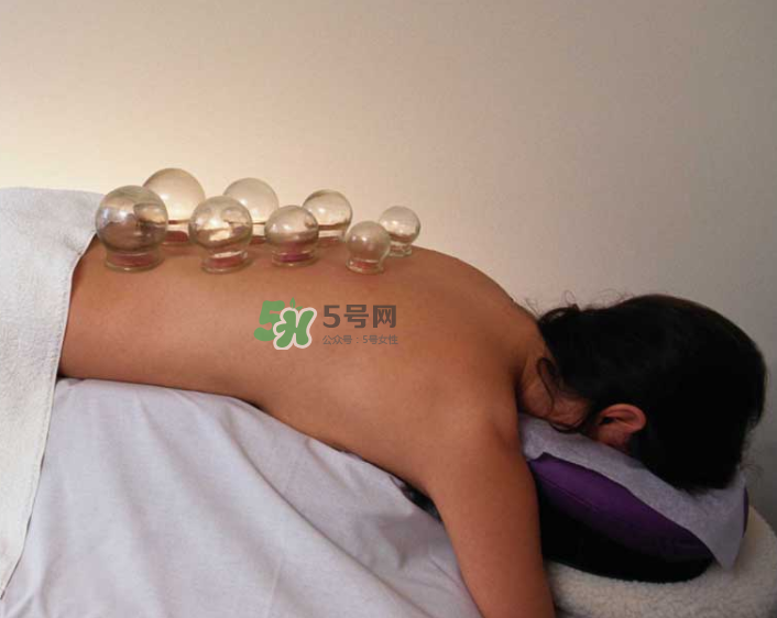 拔火罐一次多長時間？拔火罐一般多長時間？