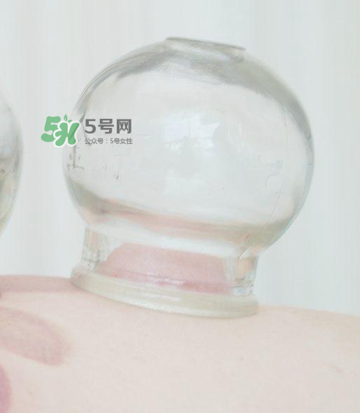 拔火罐一次多長時間？拔火罐一般多長時間？