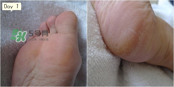 baby foot足膜怎么用？baby foot足膜使用方法