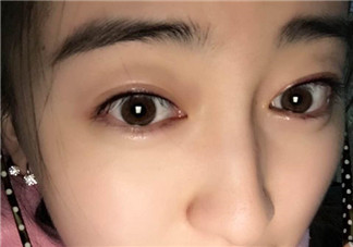 做美瞳線會(huì)不會(huì)掉睫毛？做美瞳線掉睫毛怎么辦？