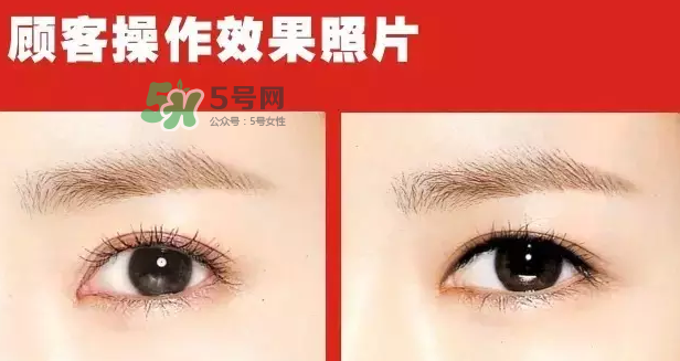 美瞳線有必要做嗎？做美瞳線多少錢？