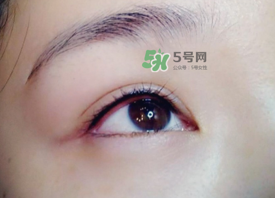 做美瞳線疼嗎？做美瞳線后要注意什么？