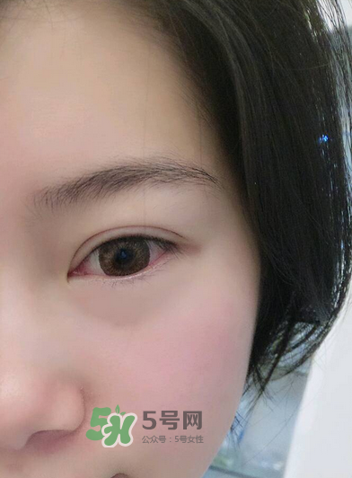 做美瞳線疼嗎？做美瞳線后要注意什么？