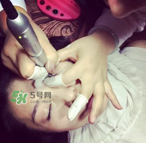 做美瞳線要打麻藥嗎？做美瞳線麻藥怎么敷？