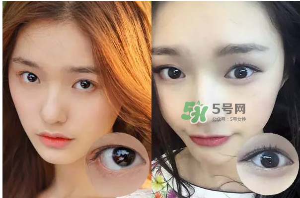 做美瞳線會(huì)不會(huì)掉睫毛？做美瞳線掉睫毛怎么辦？
