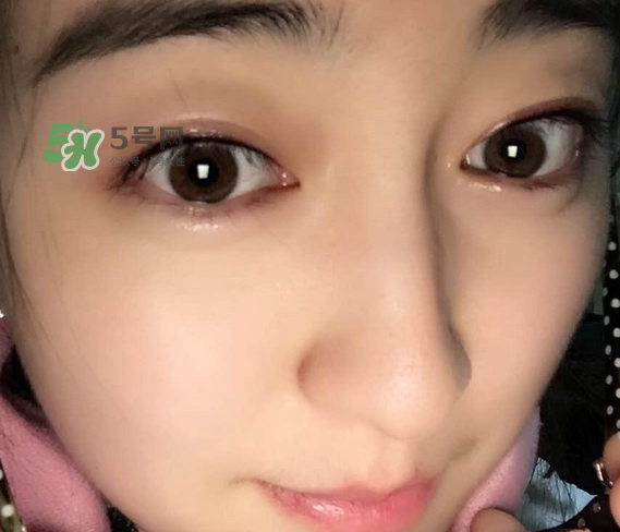 做美瞳線可以喝酒嗎？做美瞳線喝酒有影響嗎？