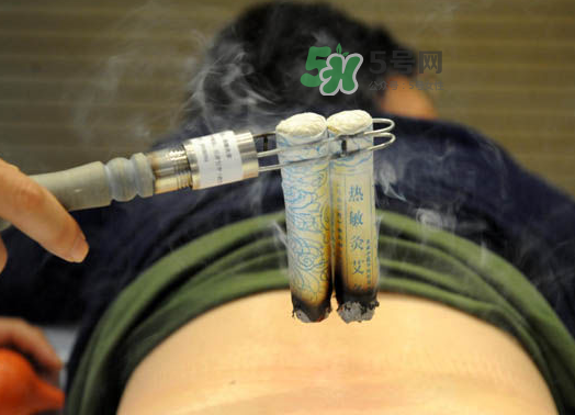 三伏天艾灸后能吹空調(diào)嗎？三伏天艾灸后能吹電扇嗎？