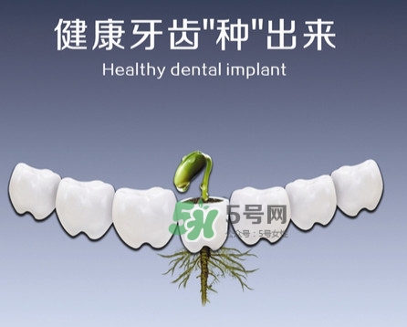 種植牙費用多少錢？國產(chǎn)種植牙價格