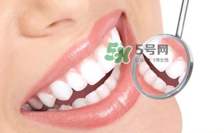 牙齒縫隙大怎么辦？牙縫大帶牙套有用嗎