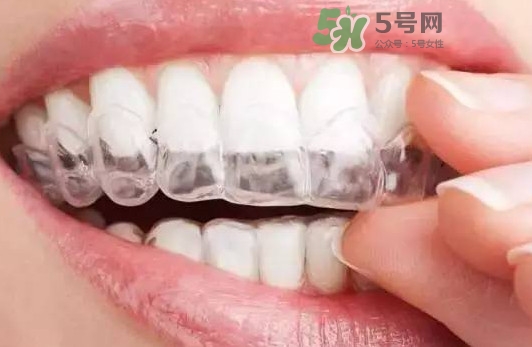 牙齒有縫隙可以補(bǔ)嗎？牙齒縫隙大能補(bǔ)嗎