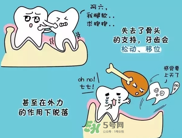 牙齒松動會自己好嗎？牙齒松動會自己掉嗎