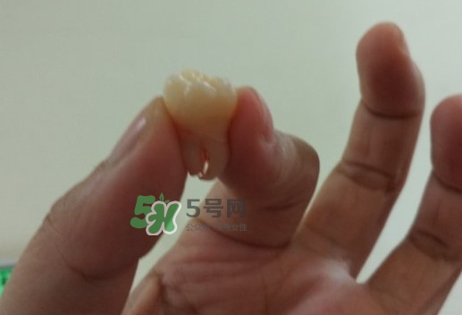 拔智齒痛嗎？智齒拔了多久洞會好？