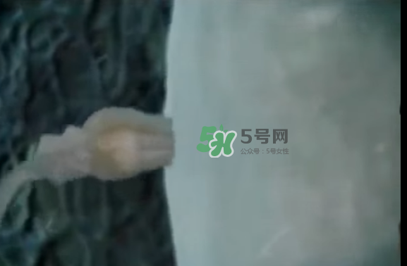 懷孕初期怎么保胎？陰道出血是流產(chǎn)征兆嗎？