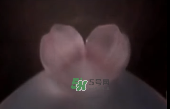 懷孕初期怎么保胎？陰道出血是流產(chǎn)征兆嗎？