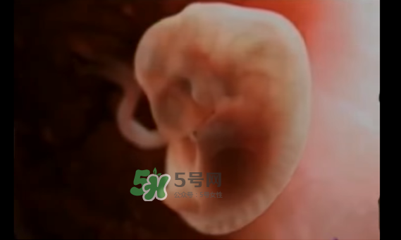 懷孕初期怎么保胎？陰道出血是流產(chǎn)征兆嗎？