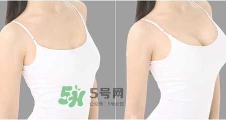 女性乳頭癢是怎么回事？女性乳頭癢要怎么治療？