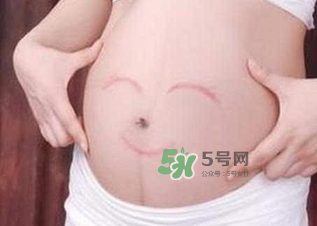 產(chǎn)婦胃脹氣怎么緩解？產(chǎn)婦胃脹氣怎么辦？