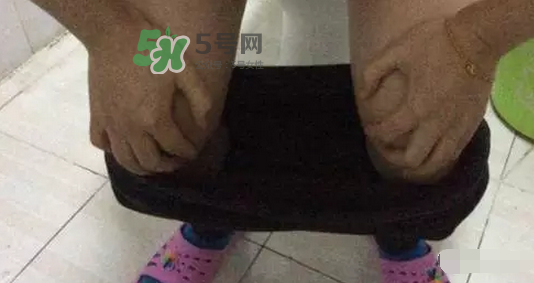 孕期可以蹲著上廁所嗎？孕期上廁所會壓到寶寶嗎？