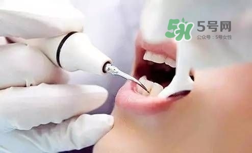 孕婦能矯正牙齒嗎？懷孕期間可以矯正牙齒嗎？