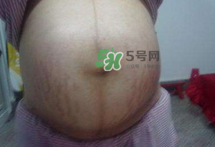 懷女孩肚子上會長毛嗎？懷女孩肚子特征圖片