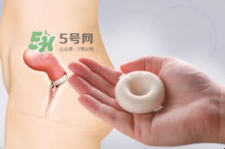 殺精劑有什么副作用？殺精劑的使用方法