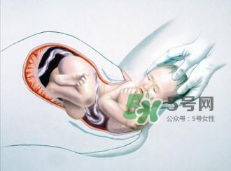 順產(chǎn)和剖腹產(chǎn)哪個(gè)好？順產(chǎn)和剖腹產(chǎn)哪個(gè)痛？