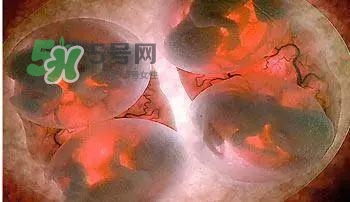 多胞胎是怎么生產(chǎn)的？多胞胎應(yīng)選擇什么分娩方式