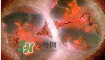 多胞胎順產(chǎn)怎么生？多胞胎剖腹產(chǎn)和單胎剖腹產(chǎn)的區(qū)別