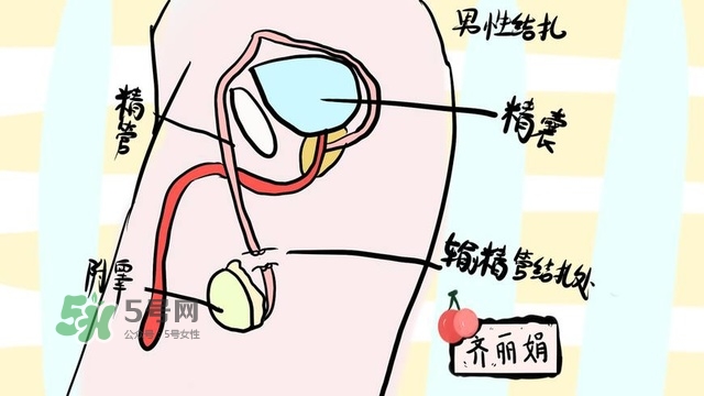 生完二胎一定要結(jié)扎嗎？生完二胎結(jié)扎好不好？