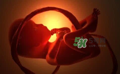 寶寶臍帶繞頸只能剖腹產(chǎn)嗎？胎兒臍帶繞頸孕婦有什么感覺