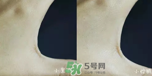 小黑瓶和小棕瓶可以一起用嗎？小棕瓶和小黑瓶哪個先用