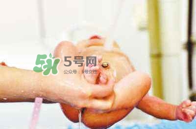 羊水栓塞是醫(yī)療事故嗎？羊水栓塞多發(fā)生于順產(chǎn)還是剖腹產(chǎn)？