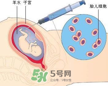 羊水栓塞是怎么回事？羊水栓塞怎么預(yù)防？