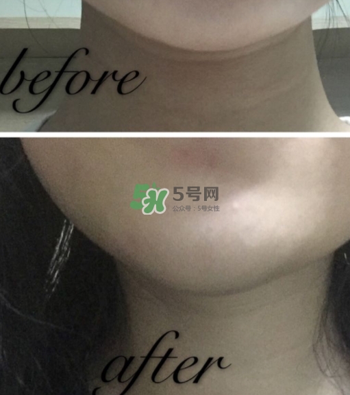 olay小白瓶有哪些版本？olay小白瓶版本區(qū)別