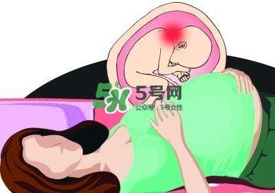 孕婦左側(cè)臥睡不著怎么辦？孕期左側(cè)睡不舒服怎么辦？