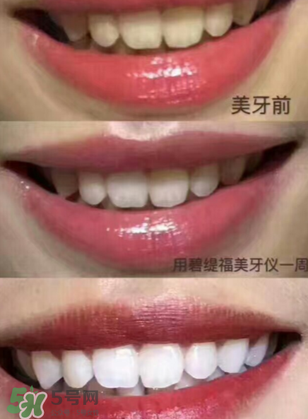 美牙儀能用水洗嗎？美牙儀能用多久？